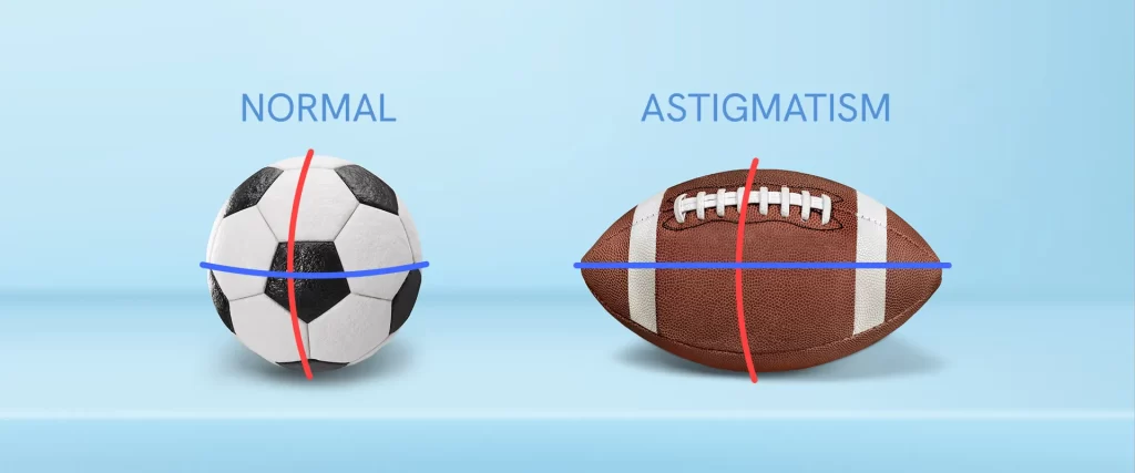 The difference between a normal and an astigmatic eye