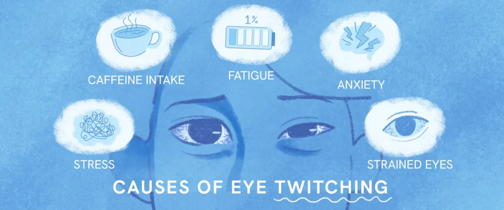 Causes of eye twitching